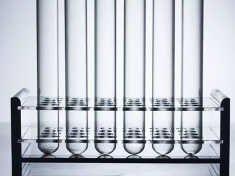 Jak diagnozuje się stwardnienie rozsiane?