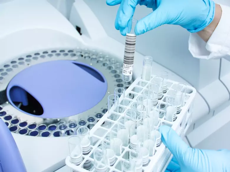 Czy miRNA-16 pomoże leczyć Alzheimera?