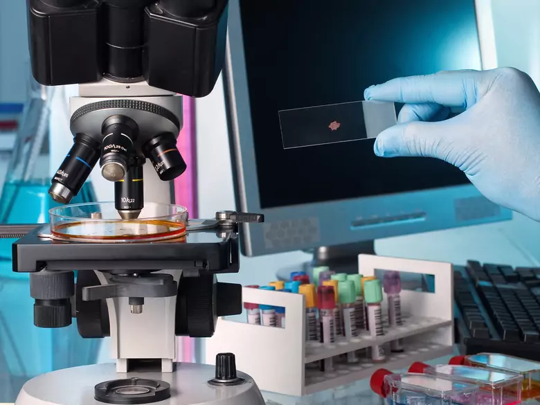 Autyzm i padaczka jako przyczyny zwiększonej śmiertelności