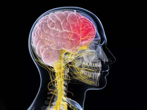 Opryszczkowe zapalenie mózgu - przyczyny, objawy, diagnoza, leczenie