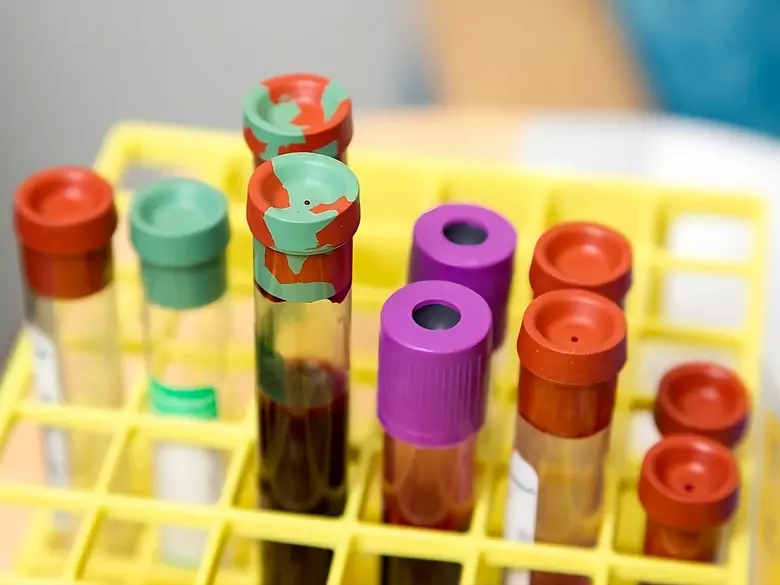 Onkopakiet - dlaczego badanie mikroelementów jest tak ważne dla wykrycia raka?